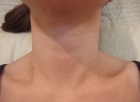 은근히 젊은 사람들도 스트레스 많이 받는다는 부위 | 인스티즈