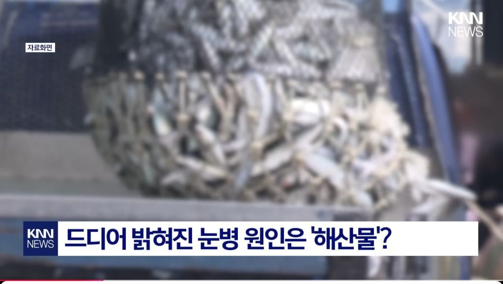 최근 확산중인 "중국발 미스테리 눈병" | 인스티즈