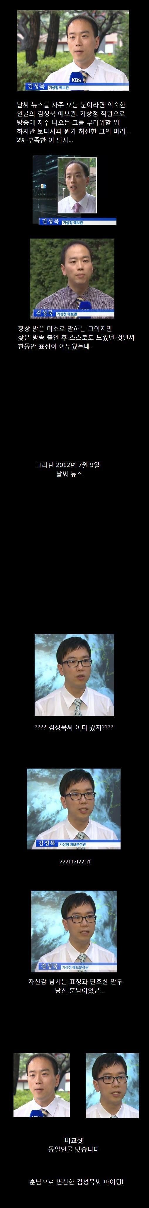 남자가 머리를 심는 이유 | 인스티즈