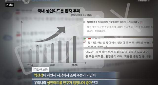 얼굴에 뭉치는 여드름 '산성피지'의 진실.jpg | 인스티즈