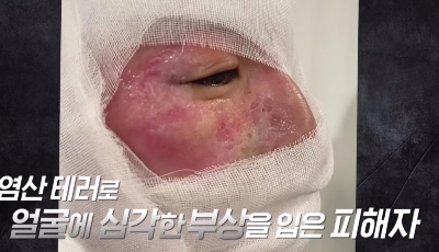 민아가 당한 끔찍한 스토킹의 과정 ..jpg | 인스티즈