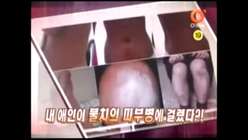 불치병에 걸린 남자친구.jpg | 인스티즈