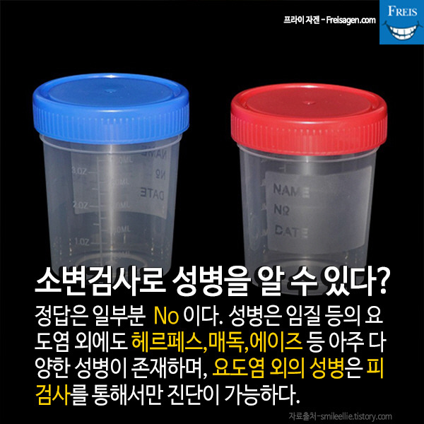 대머리는 정력이 좋다? 우리가 잘못 알고있는 섹스 지식.jpg | 인스티즈