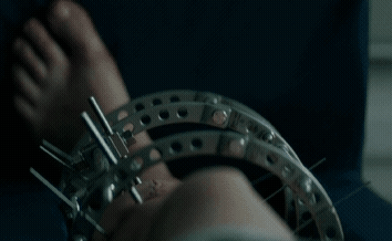 제가 발레리나인데요. 부상당한 후에 스파이 제의를 받았습니다.gif | 인스티즈