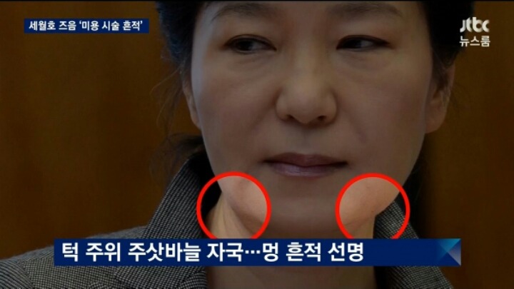 오늘자 JTBC 세월호 참사직후 피부시술 흔적 | 인스티즈