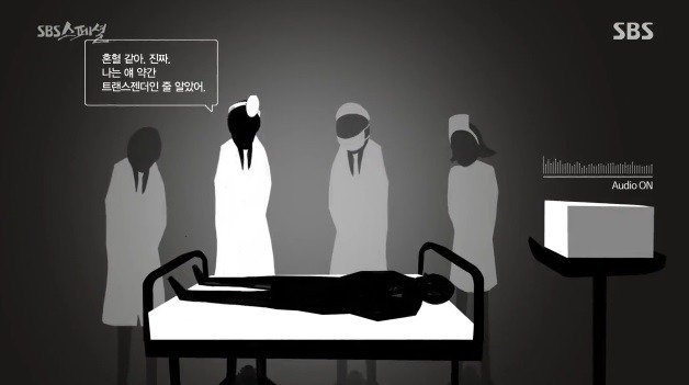 성형 수술 받은남자가 녹음한 의사들 잡담... | 인스티즈