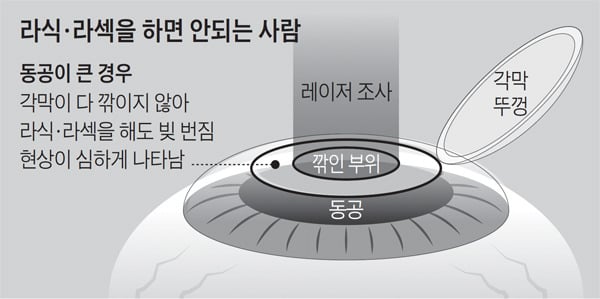 부작용이 있다 없다로 논란인 수술 | 인스티즈