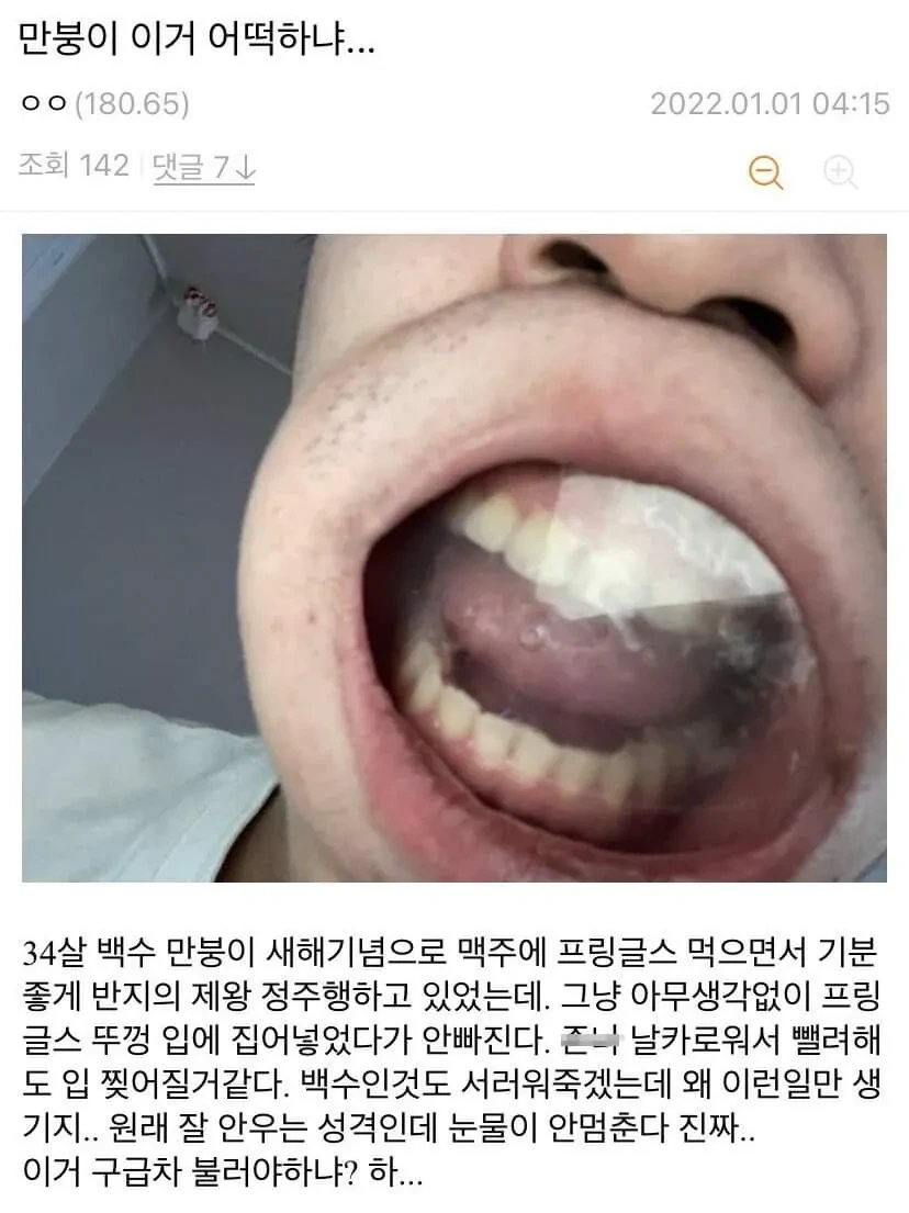 프링글스 뚜껑 입에낀 사람 | 인스티즈