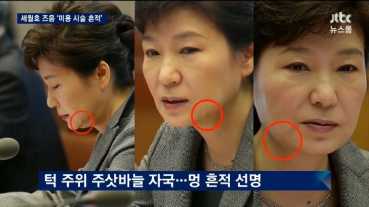 오늘자 JTBC 세월호 참사직후 피부시술 흔적 | 인스티즈