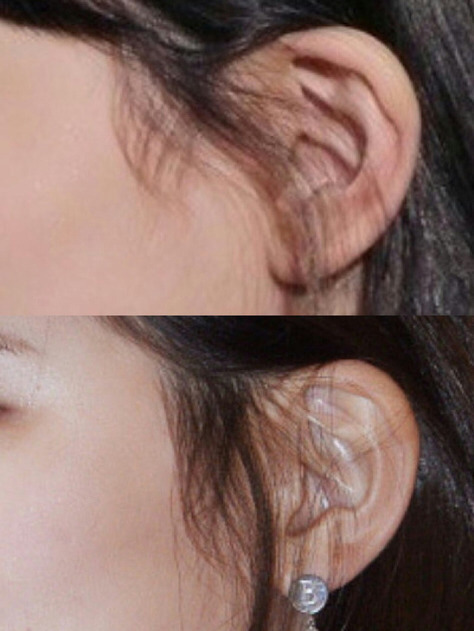 다이어트로 변화한 태연 손가락,수지 귀 | 인스티즈