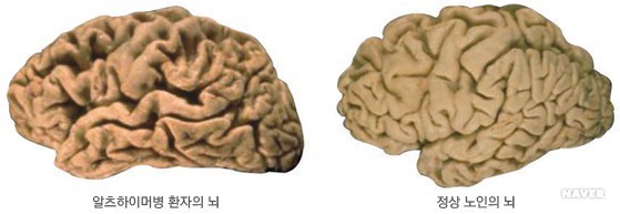 이세상에서 둘중하나만 없앨수있다면?.JPG | 인스티즈