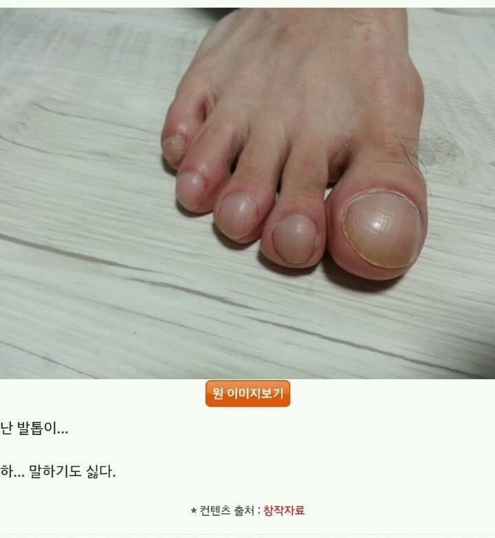 발톱 인증 레전드 | 인스티즈