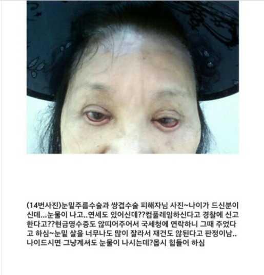 아래 글 사이코패스의사 성형 피해자들 사진 (심약자 주의!) | 인스티즈
