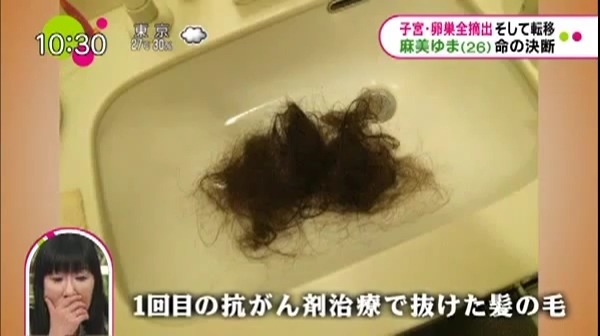내 어린 날의 진정한 친구............ 아사미 유마 | 인스티즈