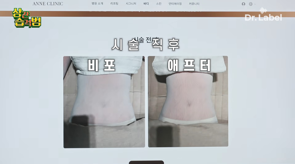 40분을 받으면 유산소 3시간 효과와 같다는 시술...jpg | 인스티즈