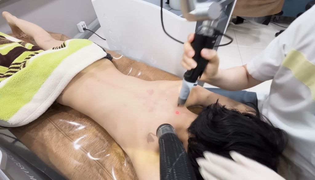 타투 제거 브이로그 올린 나나 | 인스티즈