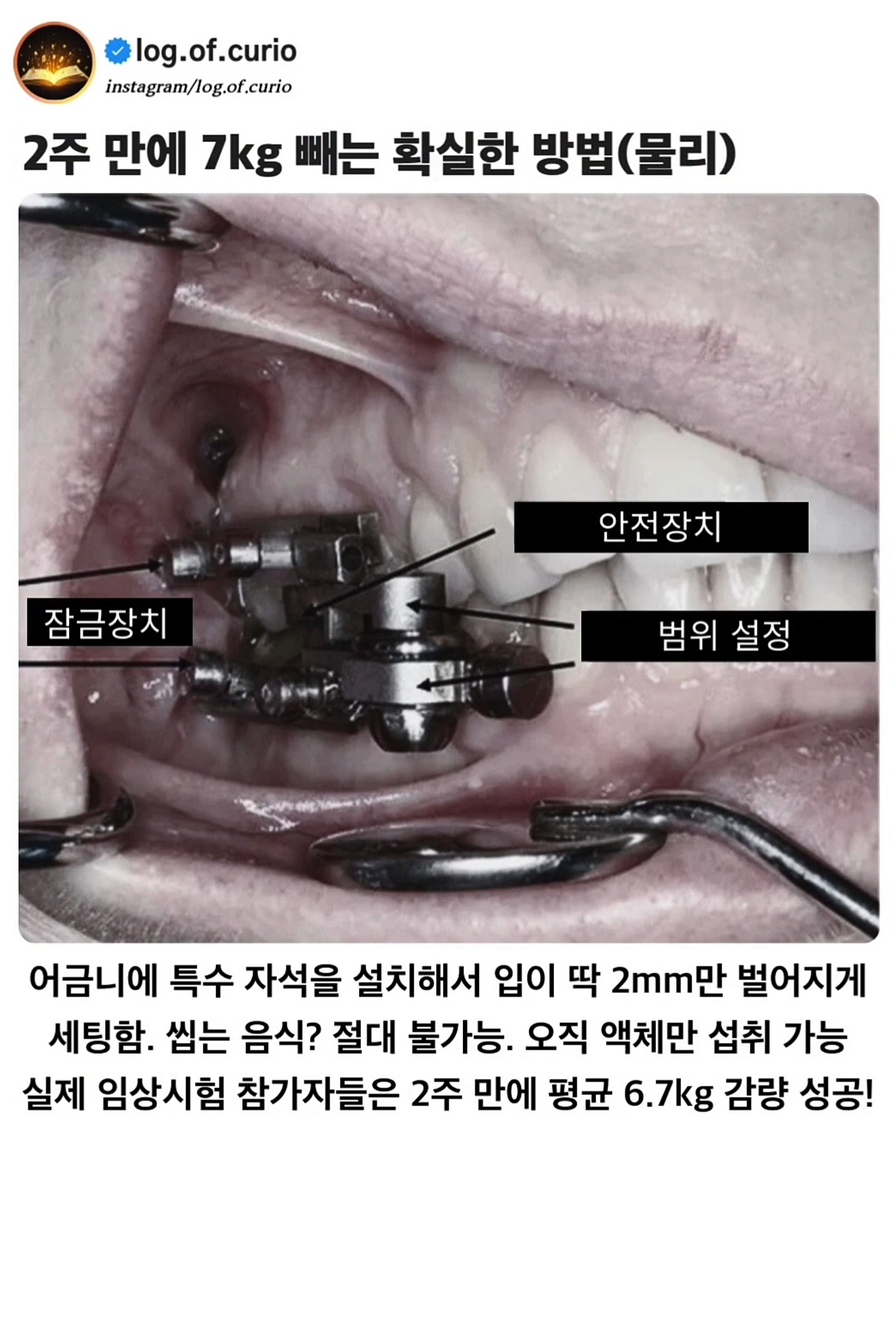 물리적으로 2주 만에 7kg 빼는 확실한 방법 | 인스티즈
