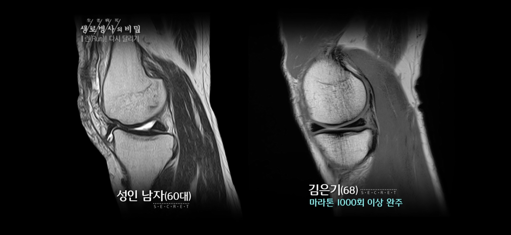 달리기 런닝 이거 완전 만병통치약임 | 인스티즈