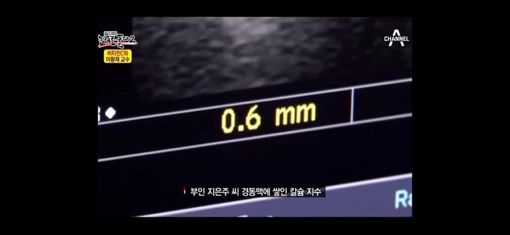 비타민c 맹신론자의 최후 | 인스티즈