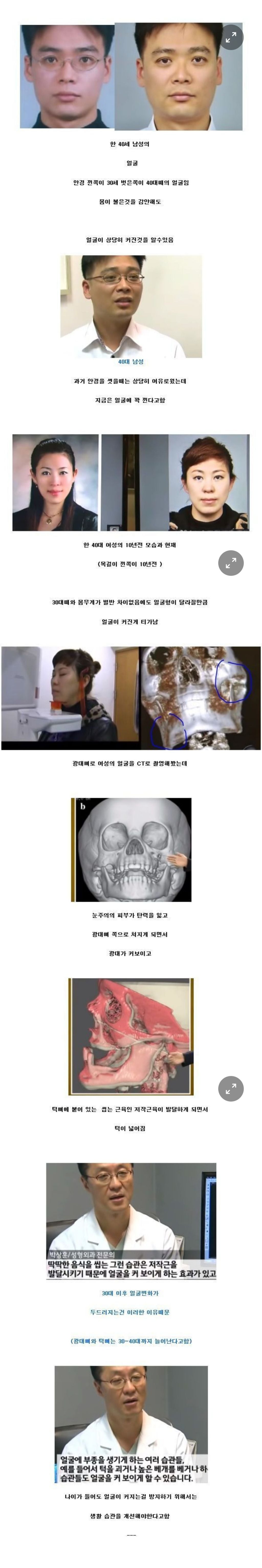  나이가 들면 얼굴이 얼굴이 커지는 이유 | 인스티즈