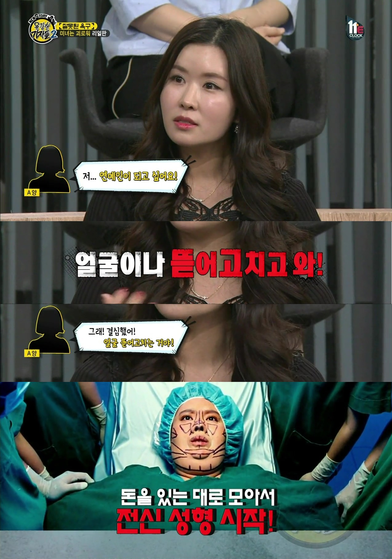 [용감한기자들] 신인 걸그룹 멤버의 전신성형.jpg | 인스티즈