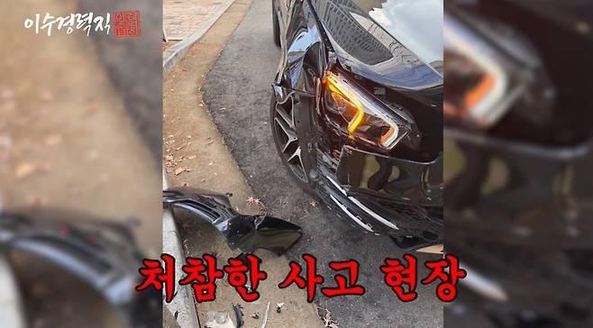 이수경, 교통 사고로 "안면부 전반 손상→전치 8주"…처참한 현장 공개 | 인스티즈