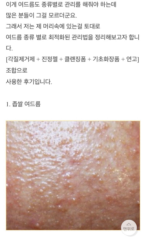  남자피부관리 온갖 여드름 종결 썰 | 인스티즈