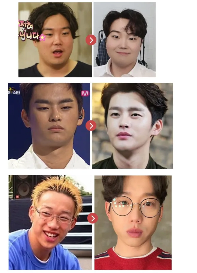 일반인이 연예인 피부가 될 수 없는 이유 | 인스티즈