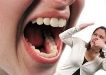 성별 상관없이 입냄새가 너무 심한 직원과 일한다면 어떻게 할거야? | 인스티즈