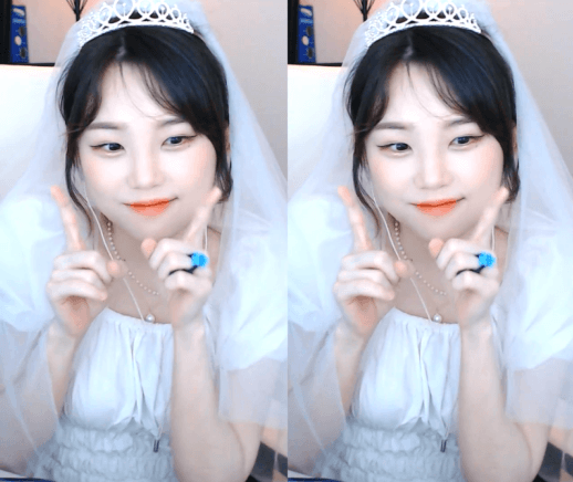성형 부작용을 겪은 우정잉...jpg | 인스티즈