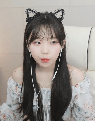 성형 부작용을 겪은 우정잉...jpg | 인스티즈