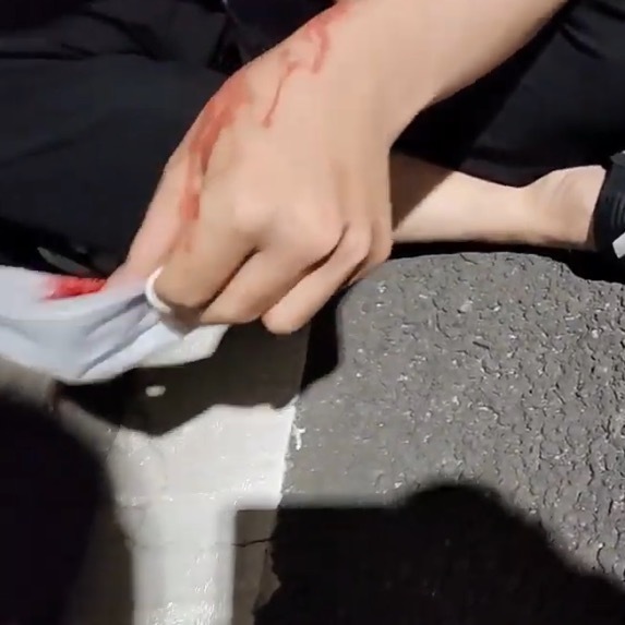 얘기 좀 하자니까 창문으로 냅다 뛰어내려버리는 남자 | 인스티즈