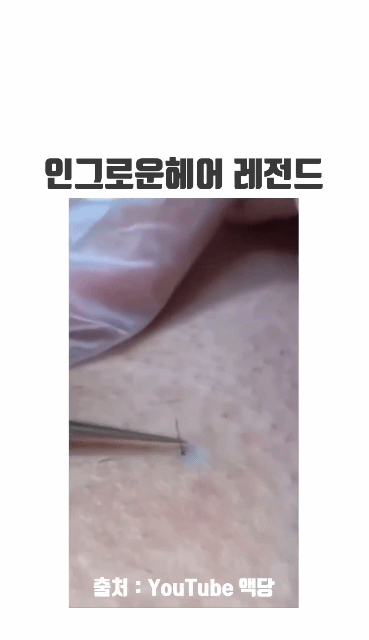 당신의 밤을 책임 질 인그로운 헤어 모음집 | 인스티즈