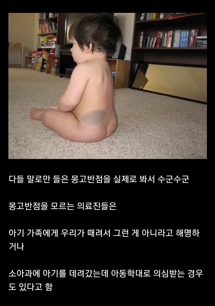 미국 산부인과에서 동양인 아기 태어나면 놀라는 이유 | 인스티즈