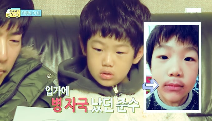 [아빠어디가] 준수 얼굴에 못생김이 묻었던 순간들ㅋㅋ.jpg | 인스티즈