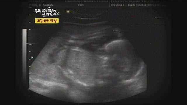 [우리아이가달라졌어요] 최강폭군 혜성이.jpg | 인스티즈