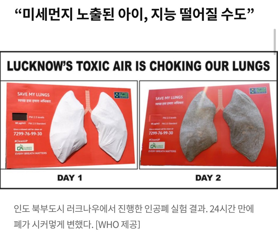 "미세먼지 노출된 인공 폐 하루 만에 새까매졌다" | 인스티즈
