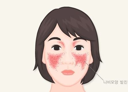 남자보다 여자가 더 잘걸리는 것 8가지 | 인스티즈