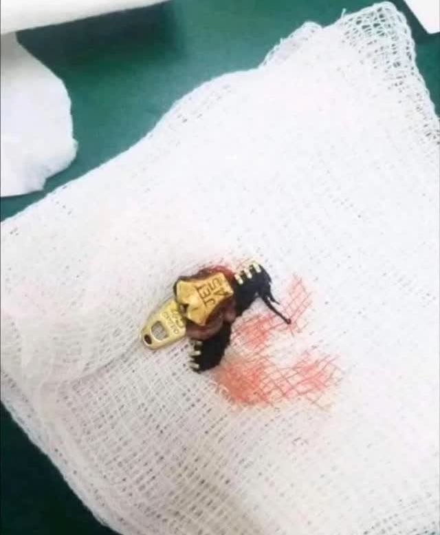 (혐) 남자만 아는 고통 | 인스티즈