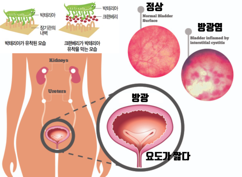 남자보다 여자가 더 잘걸리는 것 8가지 | 인스티즈