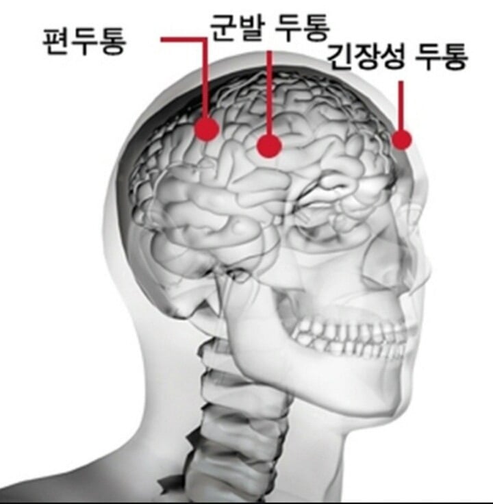 두통 심한사람 공감.txt | 인스티즈