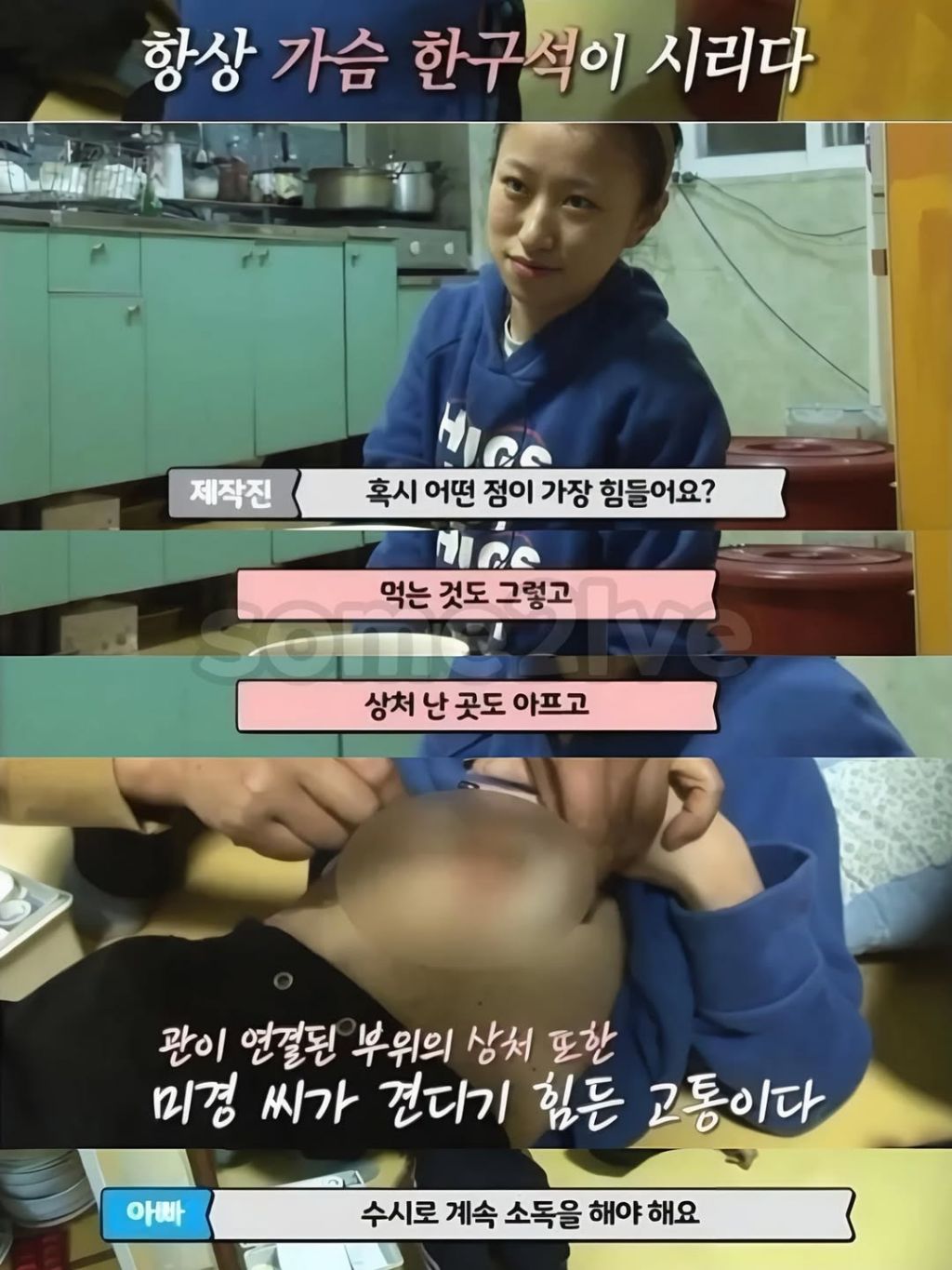 식도없이 살았던 여자분 | 인스티즈