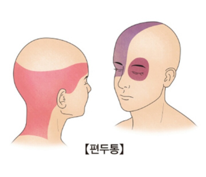 두통 심한사람 공감.txt | 인스티즈