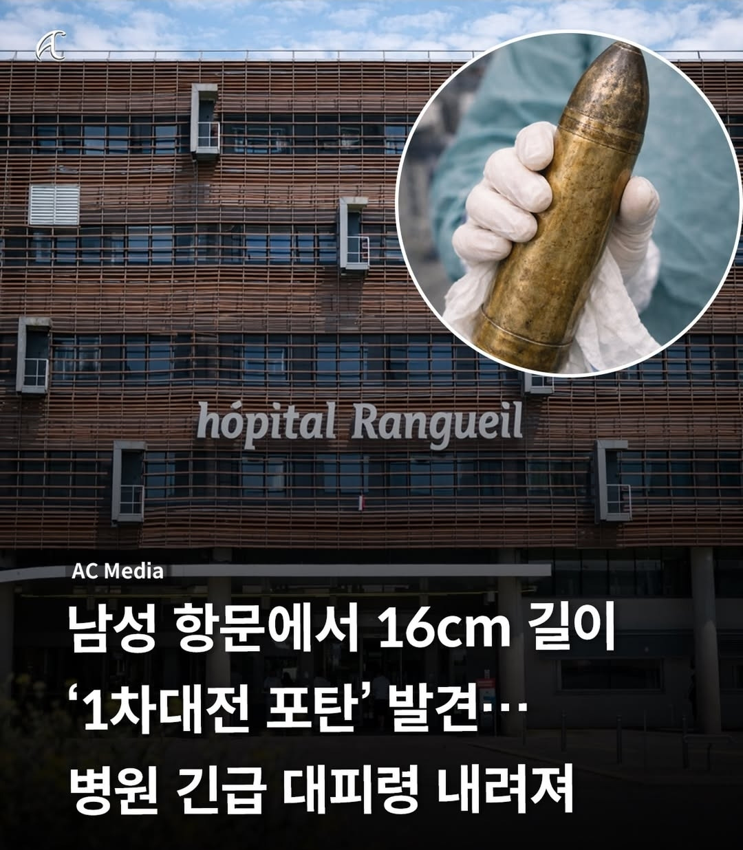 남성 항문에서 발견된 1차 세계대전 포탄 실제 모습 | 인스티즈