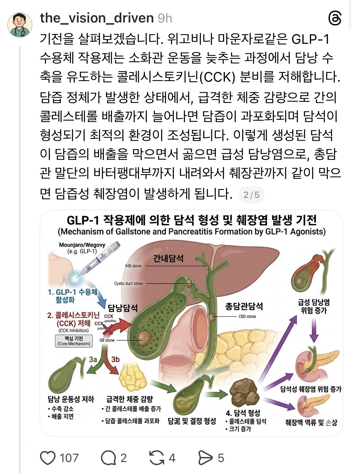 현직 응급실 전문의로서 최근 진료 현장에서 느끼는 임상적 우려를 공유하고자 합니다 (ft.마운자로) | 인스티즈