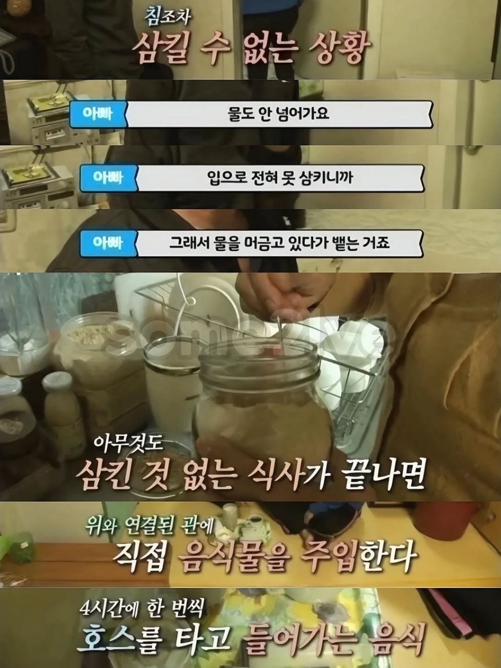식도없이 살았던 여자분 | 인스티즈