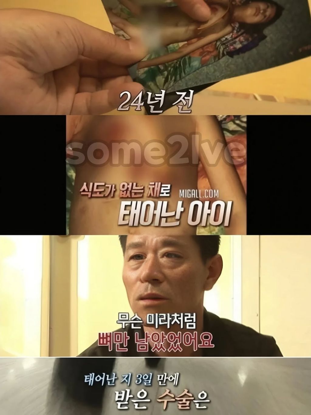 식도없이 살았던 여자분 | 인스티즈