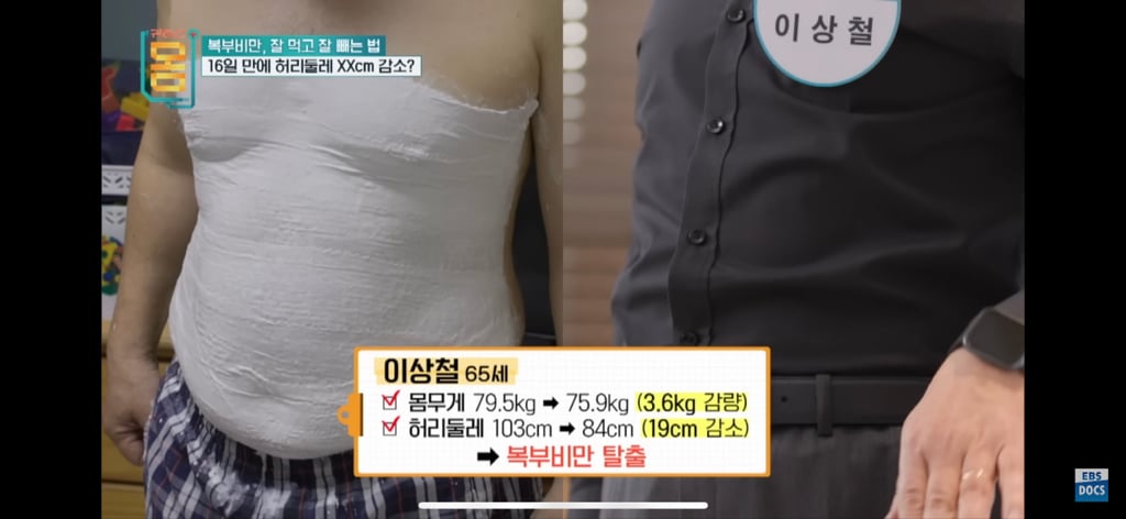 [EBS] 귀하신몸 - 복부비만 잘 먹고 잘 빼는 법 (16일동안 허리둘레 22cm 감소) | 인스티즈