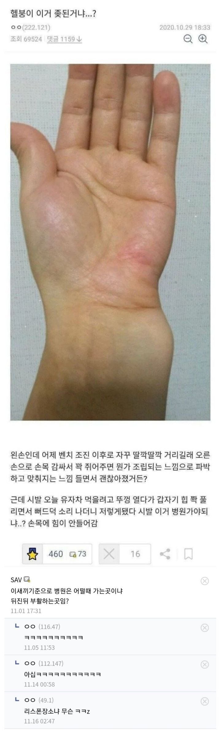 디씨의 손목 브레이커를 본 응급의학과 의사 | 인스티즈