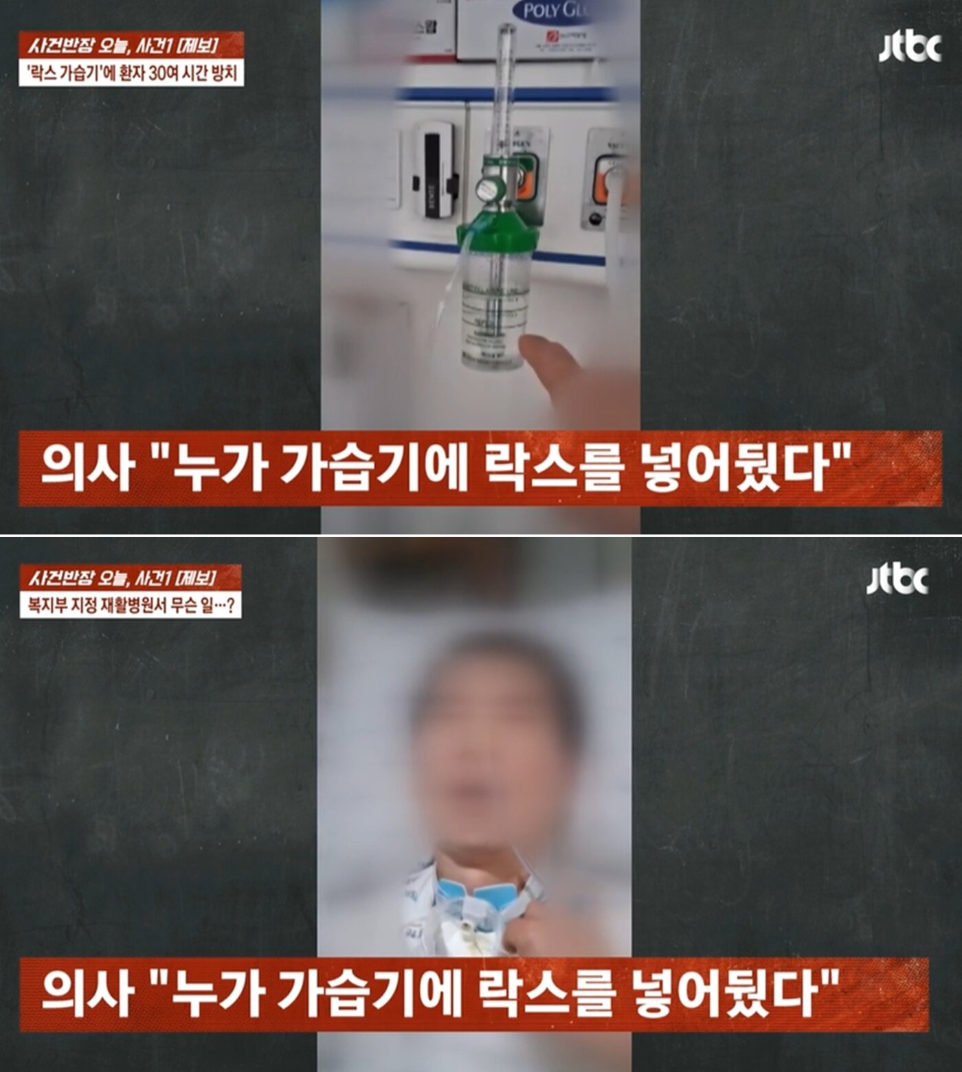 가습기에 락스 넣은 간호사 "뇌출혈 아버지, 폐렴"…병원 "실수일 뿐" 회피 | 인스티즈